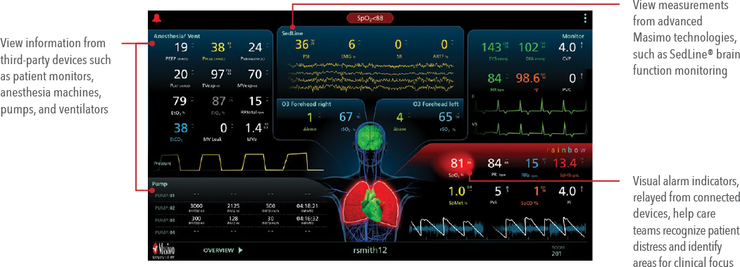 Masimo - Uniview - Patient Data