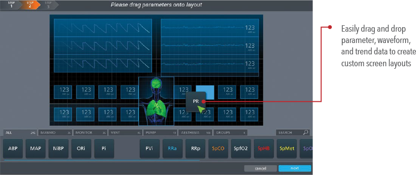 Uniview - UI of customizable screen layouts